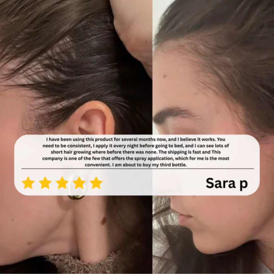 The HairRegen Roller